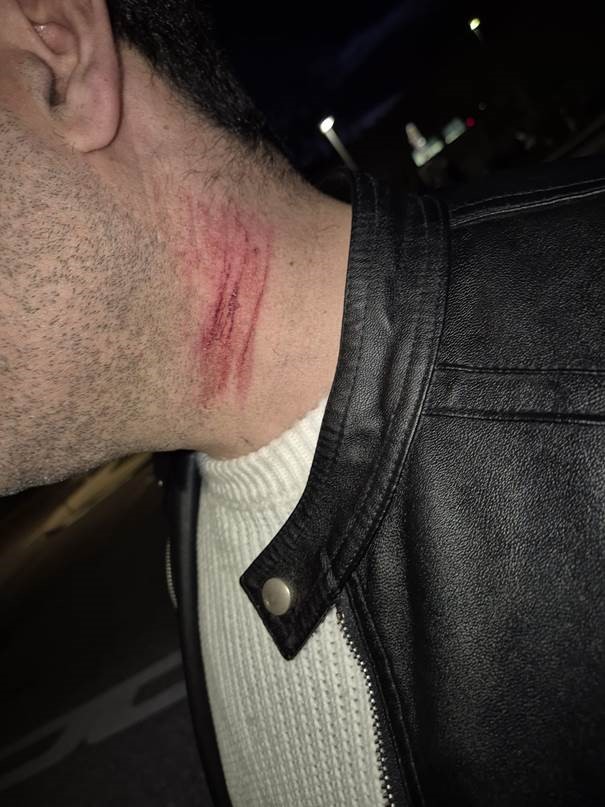 Nach Überfall: Taxiunternehmen sensibilisiert Öffentlichkeit